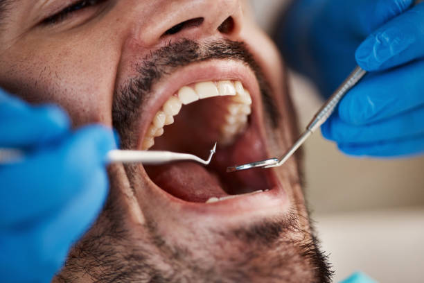 Best Chipped Tooth Repair Near Me  in Kingston, PA